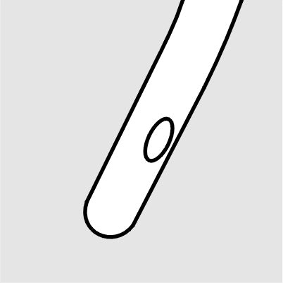 Cyclodialysis Spatula Cannula